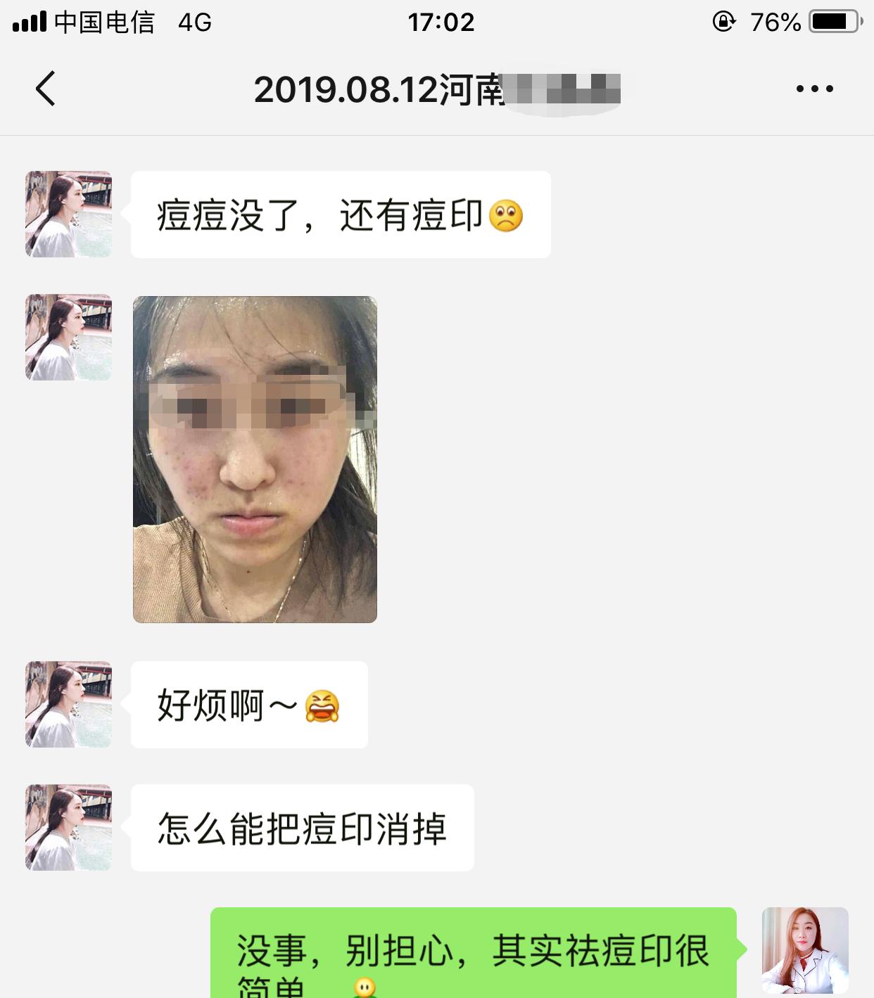 怎样祛痘印痘坑最快最有效的方法,如何祛痘印痘坑最快最有效的方法