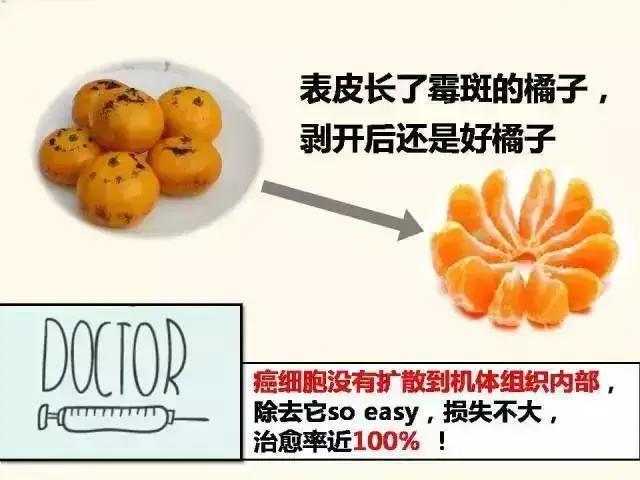 原位癌浸润癌微浸润癌区别,原位癌和微浸润癌的病理区别