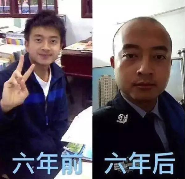 全民脱发,脱发市场的发展趋势视频讲解