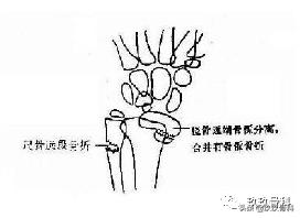 骨科术前术后注意事项,骨科手术体位安置标准流程