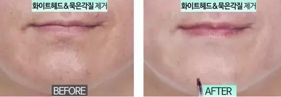 黄圣依洗面奶,黄圣依洗面奶真的有效果吗