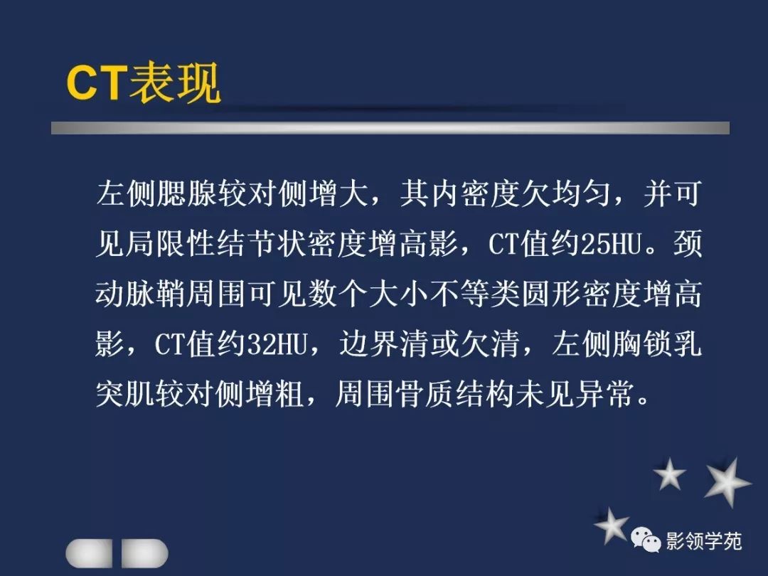 腮腺疾病影像学诊断,腮腺肿块影像诊断