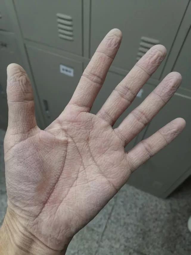 疫情过后有的人逆境崛起,被疫情压垮的人