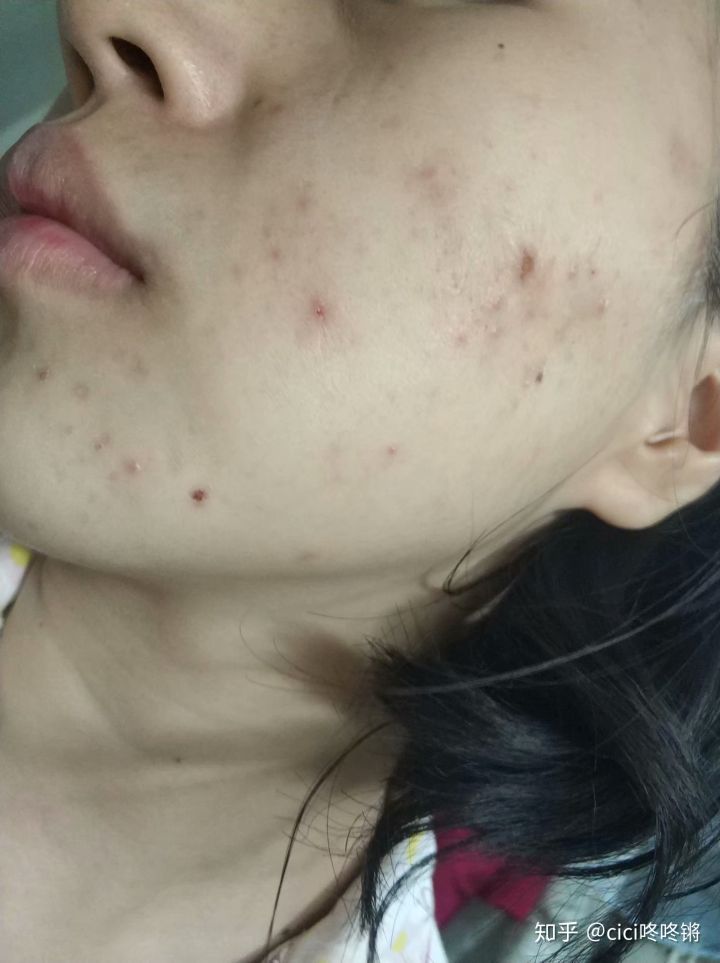 干货护肤教程手把手教你护肤,护肤美容经验分享