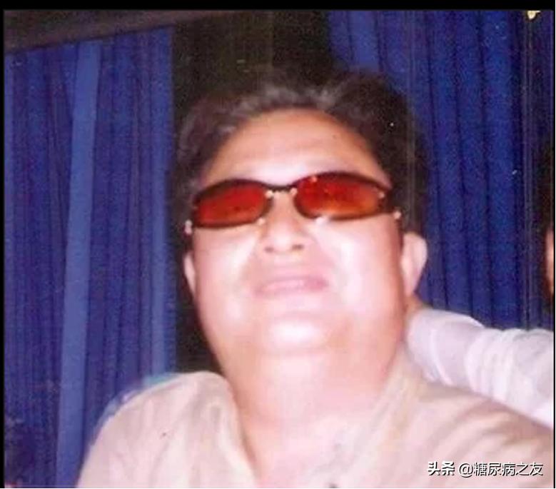 非药物治疗糖尿病血糖检测时间,坚持饮食疗法减少糖尿病并发症