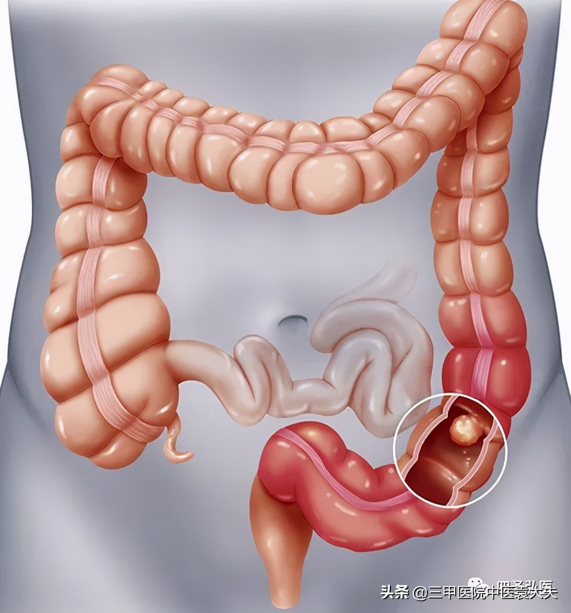 望闻问切讲解视频动画,望闻问切全集