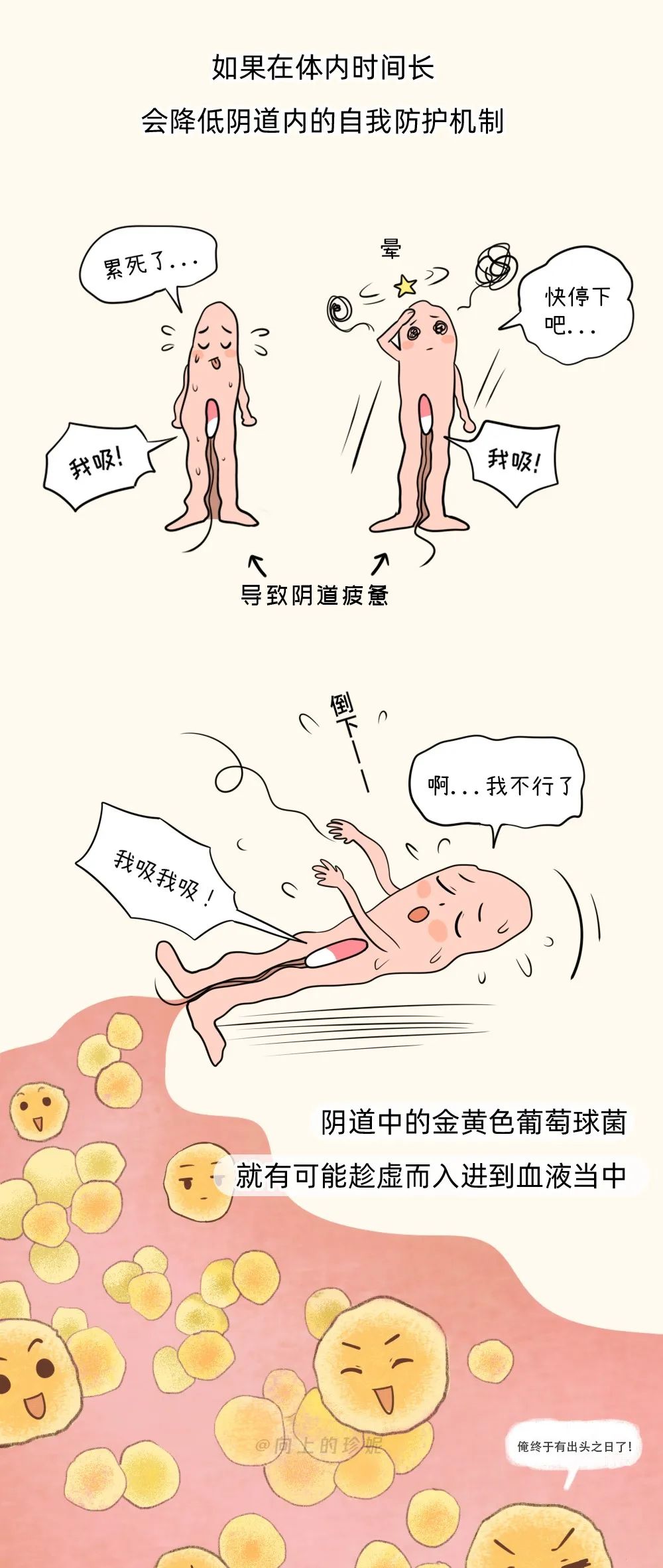 用卫生棉条会引起尿路感染吗,用卫生棉条会导致月经量少吗