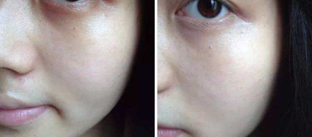 瘦脸方法17天,瘦脸方法学生适用一天瘦十斤