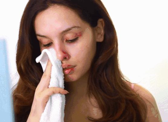 喷雾式的去黑头的东西,去黑头收缩毛孔吸黑头神器测评