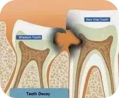 呼呼呼，跟你说话这么大风？原来是你牙齿漏风