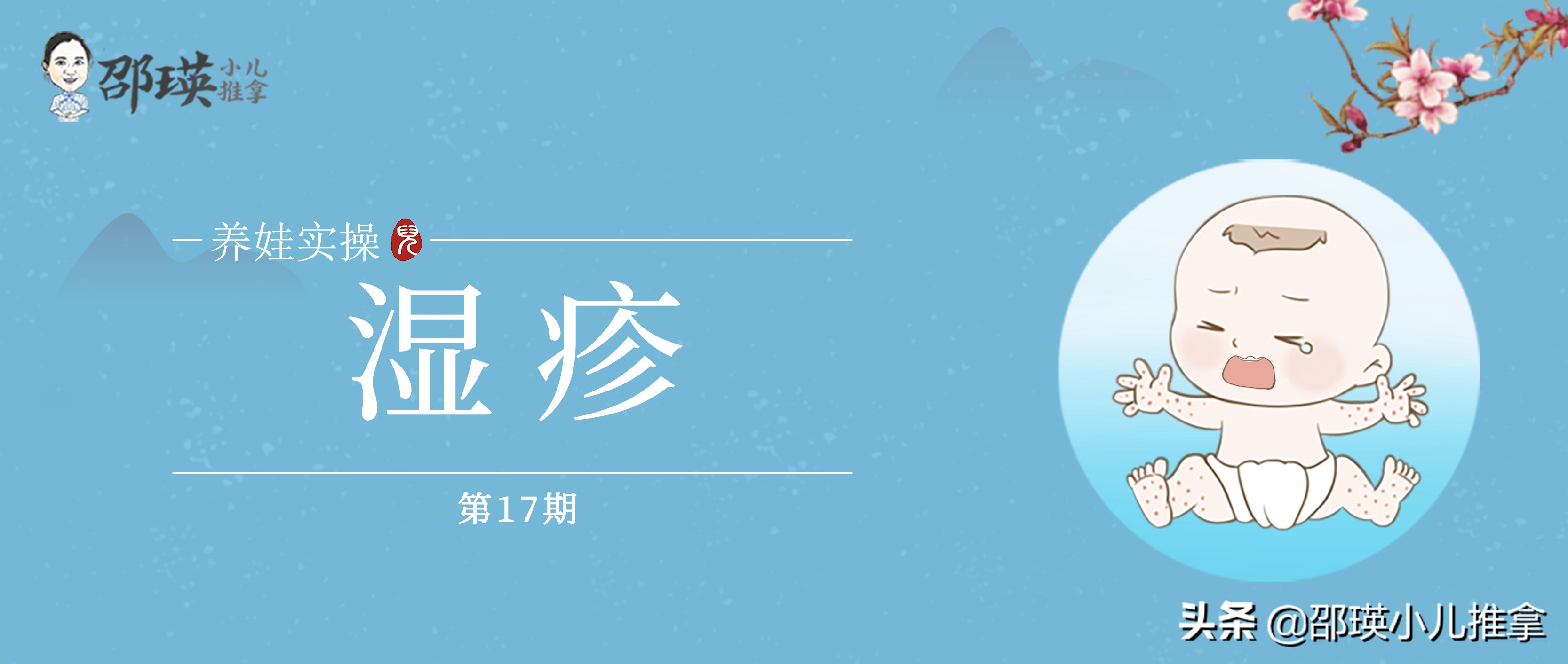 2岁孩子湿疹怎么消除又快又好,育儿湿疹怎样正确干预