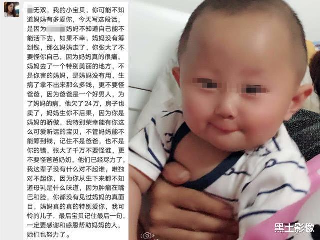 美女为生娃导致面部畸形，流浪街头自救：想活久一点，陪儿子长大