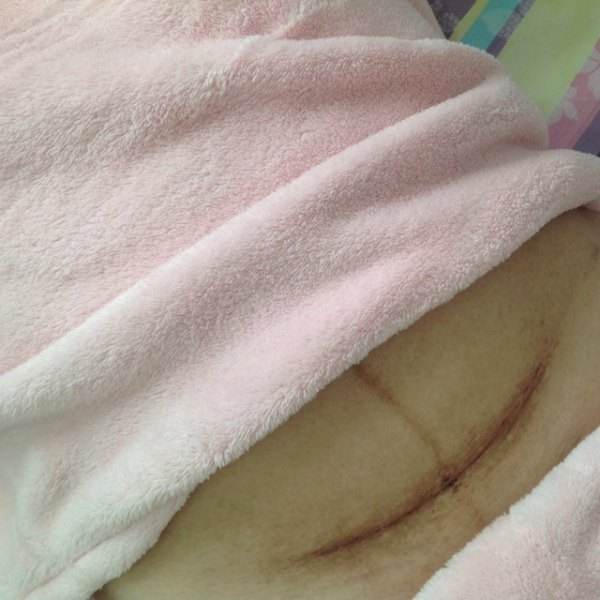 为何越来越多孕妈宁愿挨刀,也不愿选择顺产?原因不外乎这3点