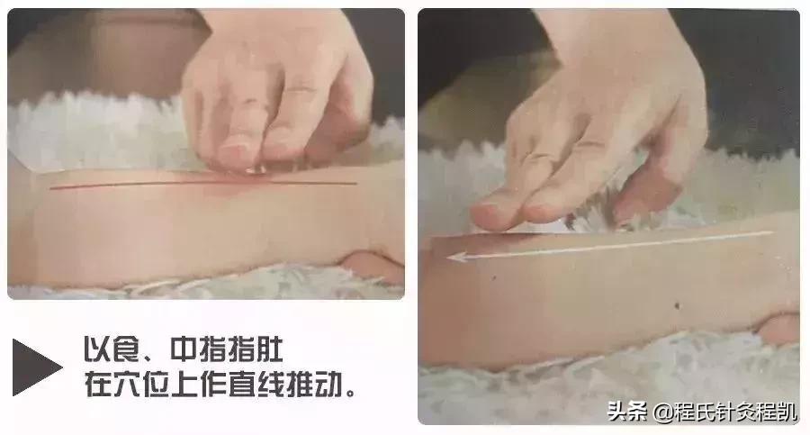 小儿荨麻疹中医反射推拿,荨麻疹夏季如何预防虫咬皮炎