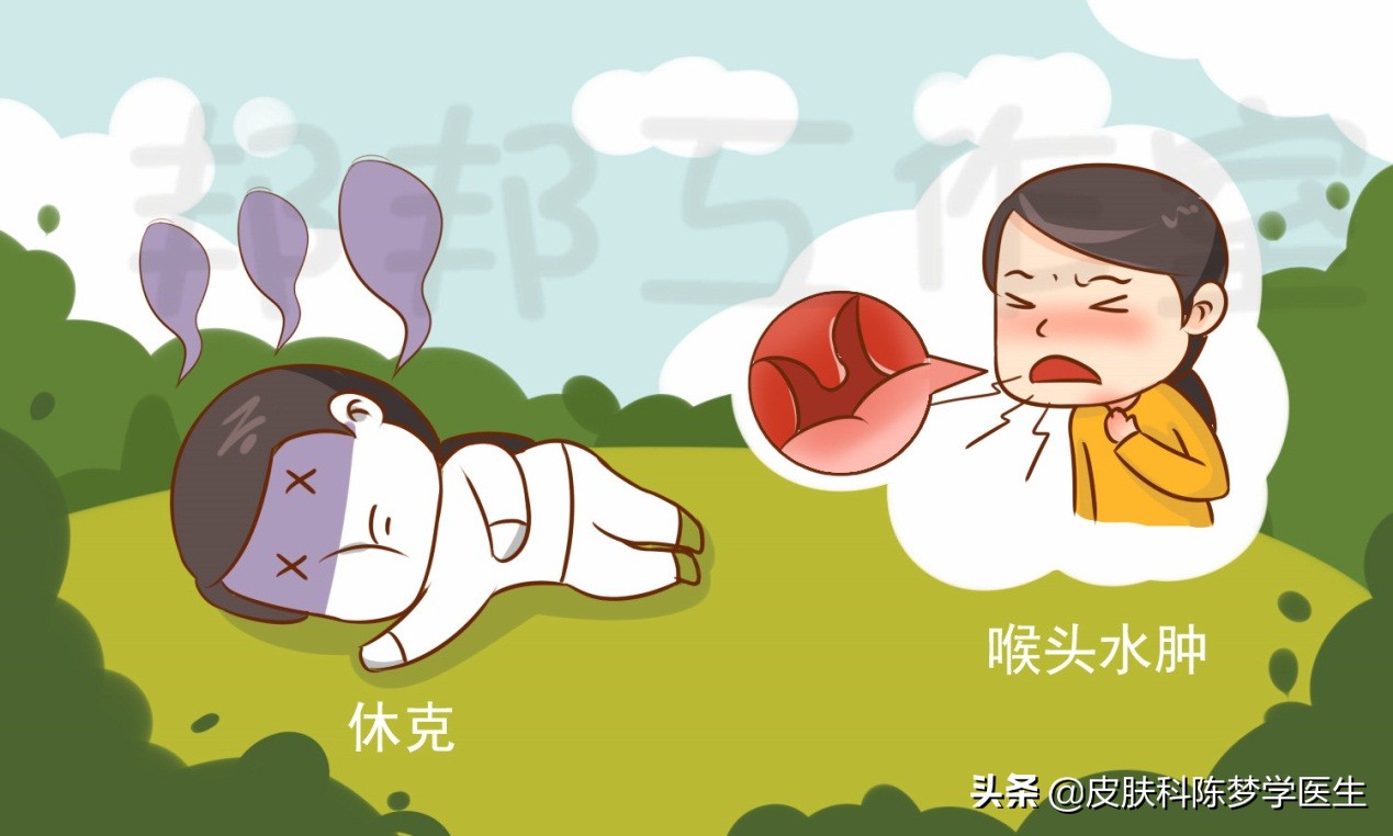 皮肤过敏发红有黄水渗出吃什么药,春季过敏眼痒打喷嚏流鼻涕