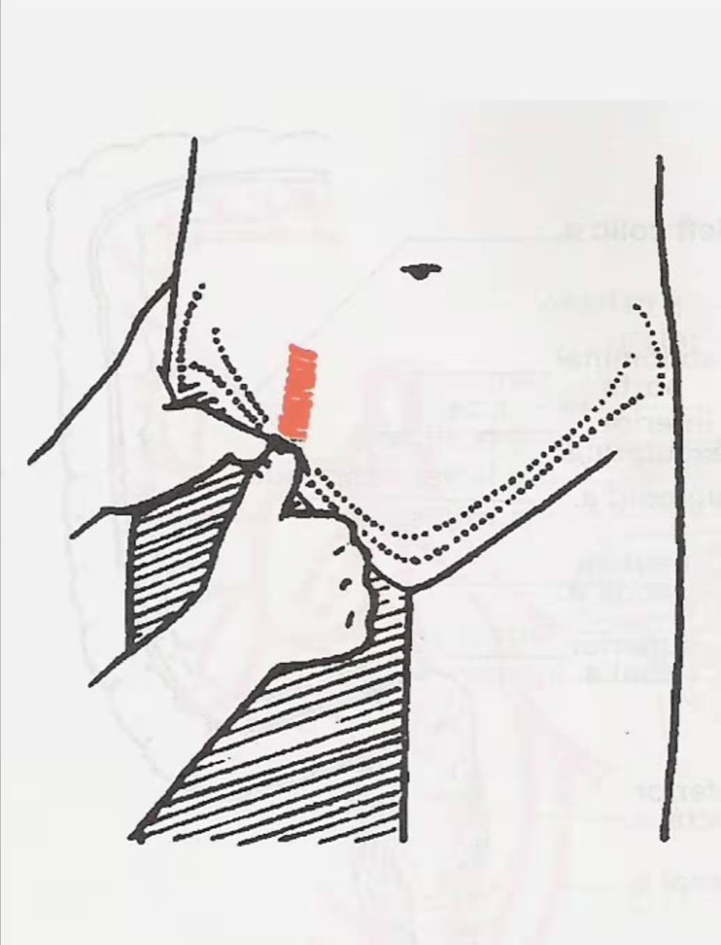 盘江总医院:家长们注意了!藏在幼儿衣物里的“隐形杀手”不容忽视