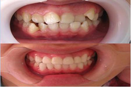 大连齿医生口腔科普,大连齿医生口腔医院怎么样