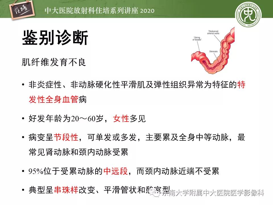 颈动脉夹层的超声表现及漏诊分析,动脉夹层与夹层动脉瘤是一样的吗
