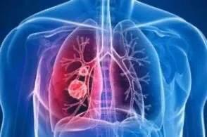 疫情之下服装行业依旧火爆,疫情下服装行业何去何从