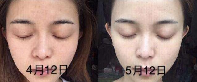 佟丽娅变白后堪比“整容”，原来是知道了这个，比烟酰胺美白更强