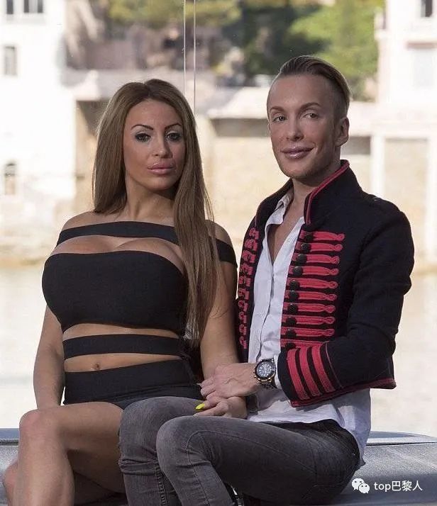 法国情侣豪掷200万，经历15次手术，只为成芭比与肯尼