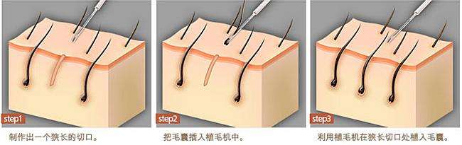 三十而已顾佳做茶叶挣到钱吗,顾佳做茶后来怎么样了