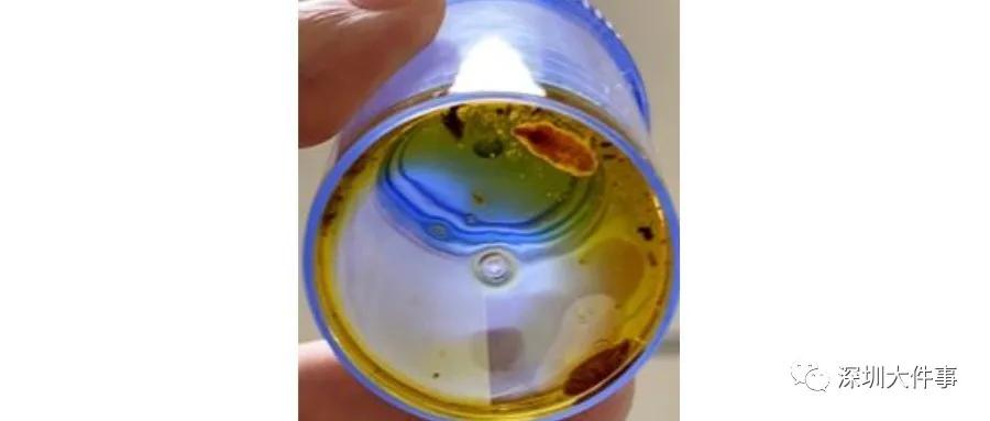 女子腹部取出活虫只因吃一道菜,女人体内查出活虫只因一个菜