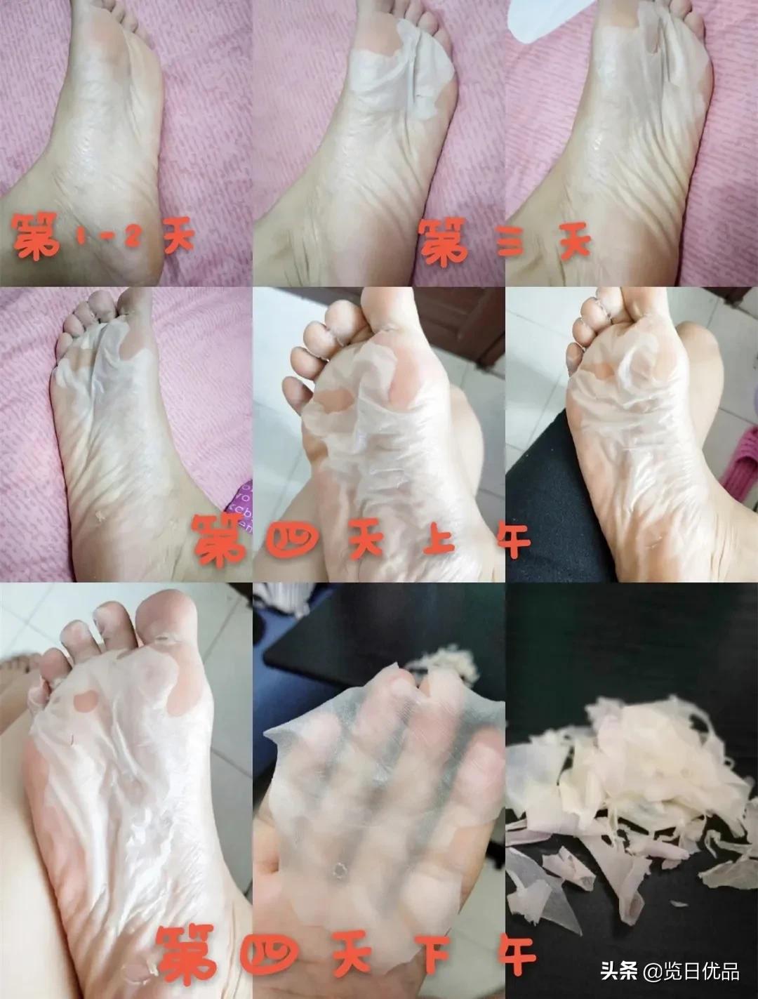 爽炸了！干丑裂的脚皮，一张完整撕掉，敢跟婴儿比姣嫩！