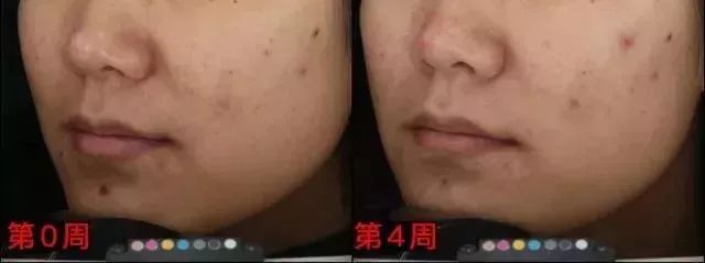 盘点平价国货不输大牌护肤品,平价大牌护肤品