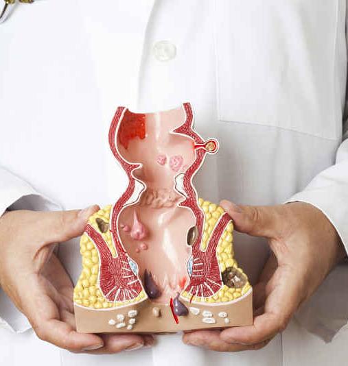 直肠指检百科,直肠指诊科普系列三