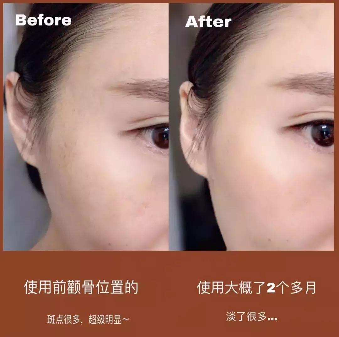 45岁李英爱近照曝光,最漂亮的冻龄女神李英爱