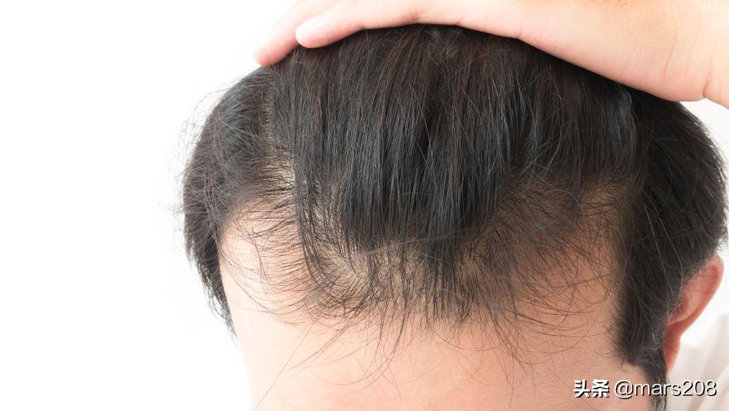 保卫发际线,防脱路上的13款防脱洗护用品使用感受