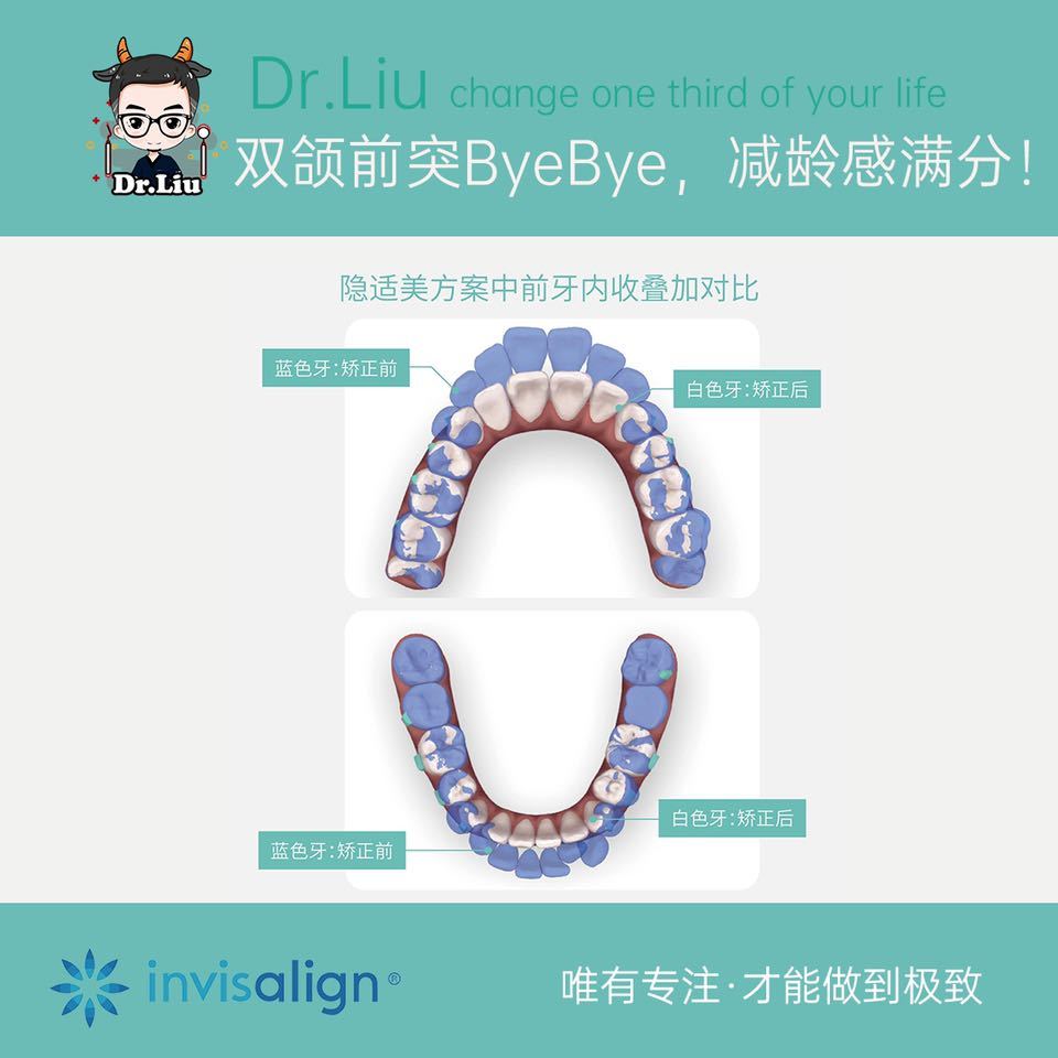 鍘﹂棬鐗欓娇缇庡,鍘﹂棬鐗欓娇鐭闅愬舰姝g暩