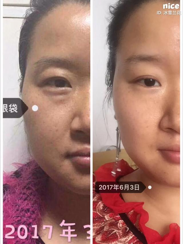 补充胶原蛋白是智商税吗,吃肉皮能补充胶原蛋白吗