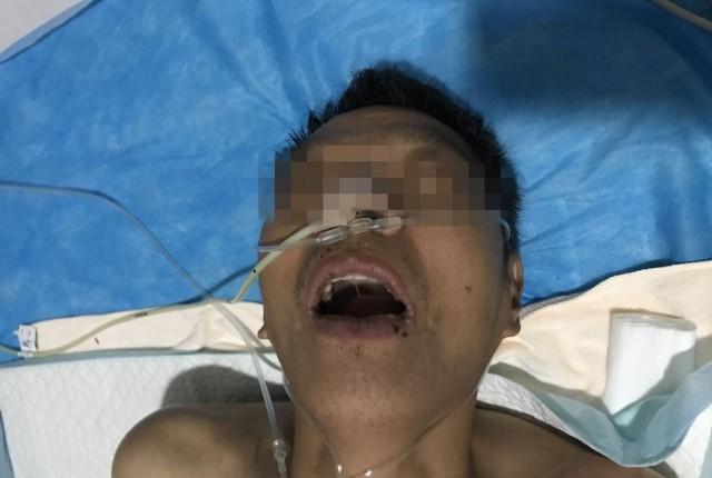 中国海关发现毒蜘蛛,安检发现毒蜘蛛