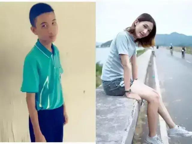 泰国整容的成功案例,全球整容技术最好的地方