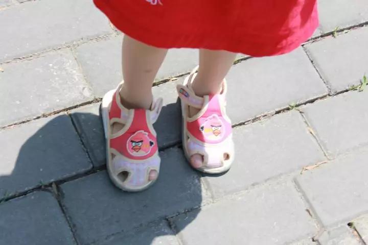 两岁宝宝腿上被虫子咬了肿很大,孩子脚被虫子咬了整个脚肿了图片