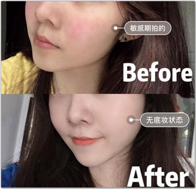 皮肤敏感自救好物推荐,皮肤泛红急救霜