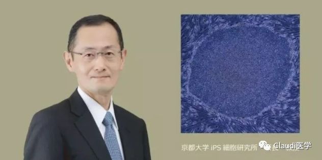 已成功两例!研究发现:移植正常眼部干细胞可治疗失明