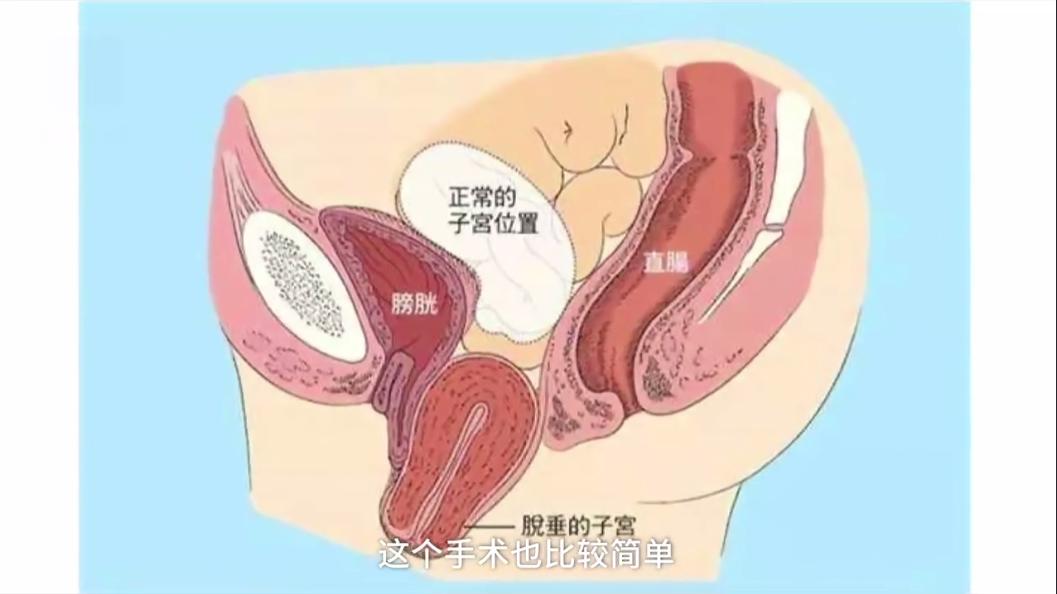 三个妈妈里,就有一个尿*禁失**