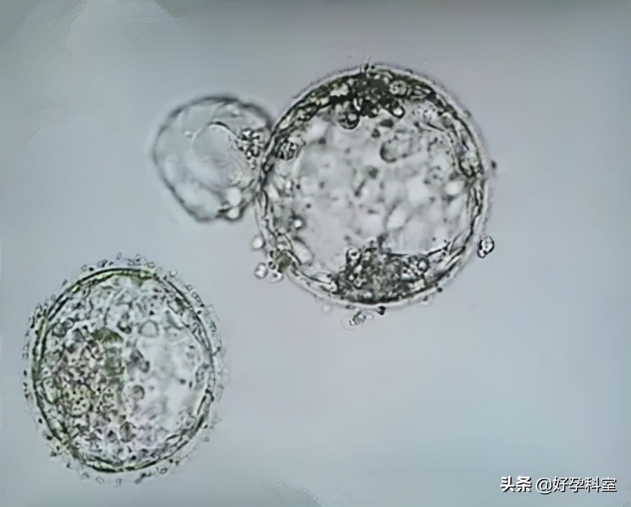 试管怎么提升妊娠率,试管婴儿怎样提高受孕成功率