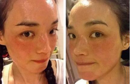 肌肤泛红敏感怎么推荐雅漾的产品,韩束保湿提亮肤色紧致肌肤