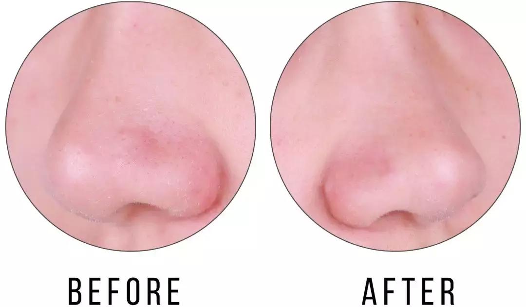 honeyroa面膜,好用的去黑头清洁面膜排行榜