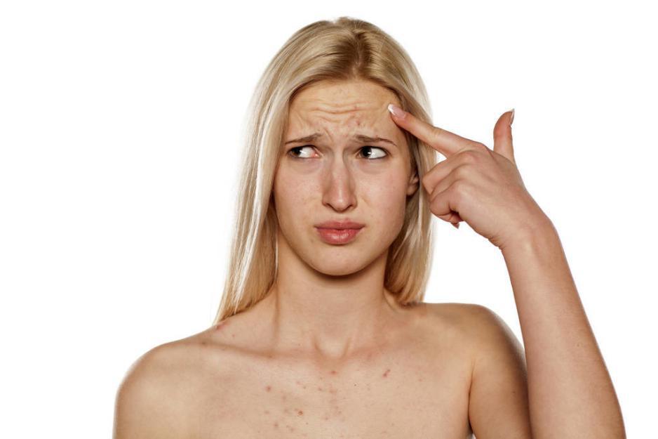 最快最有效的去痘印方法,去痘印最有效的方法是看医生