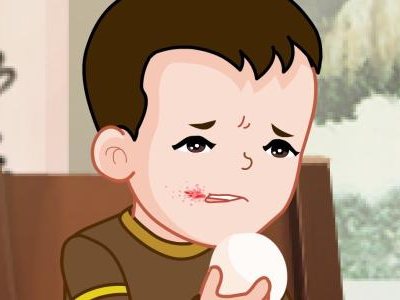 口角炎怎么判断是哪种口角炎,儿童口角炎怎么判断是哪种口角炎