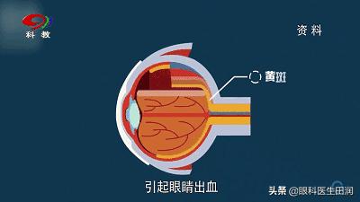 鎯呬汉鎸戞垬鑸炶箞瑙嗛,鎯呬汉鑸炶箞鎸戞垬