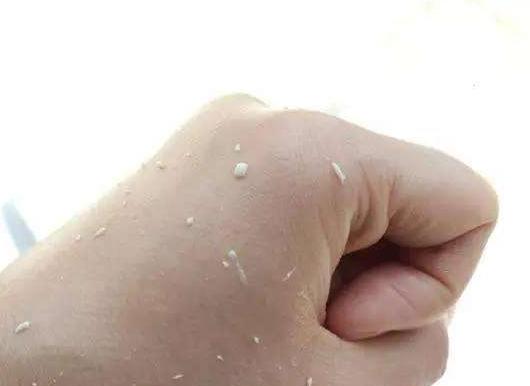 化妆搓泥是什么样子的,化妆搓泥和起皮的区别