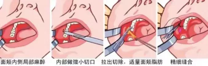 泫雅减肥前后对比照片,泫雅减肥舞原视频