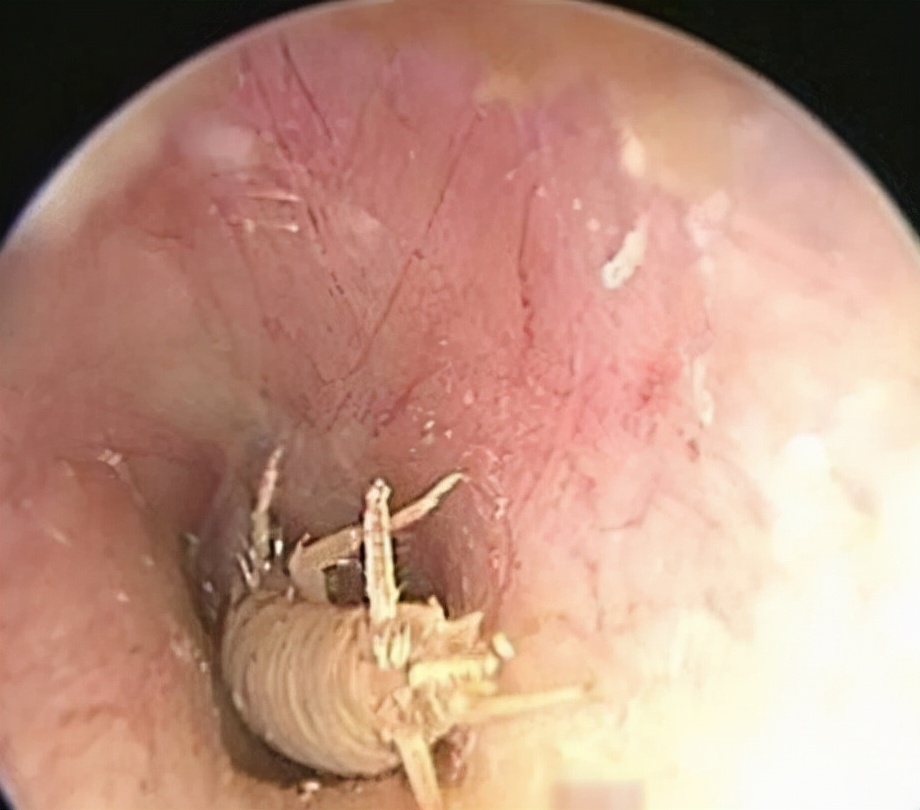 快递里发现蟑螂卵,女子网购衣服发现有蟑螂卵