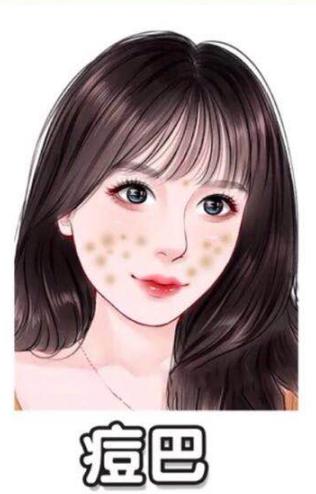 不要化妆品的祛痘小技巧,淡化脸部痘印真实有效的方法